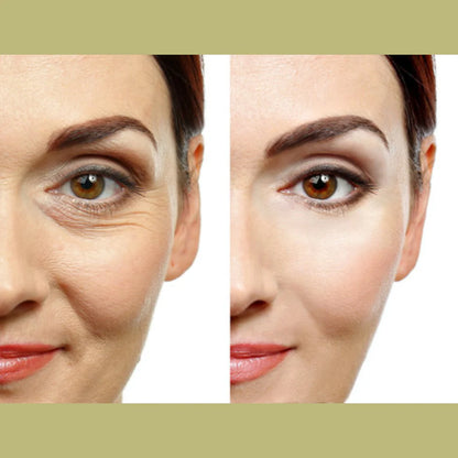 Retinal Shot Tightening Booster