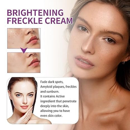 Spot Fading Urea Cream – Dark Spot Removal, Whitening & Freckle Reduction Cream