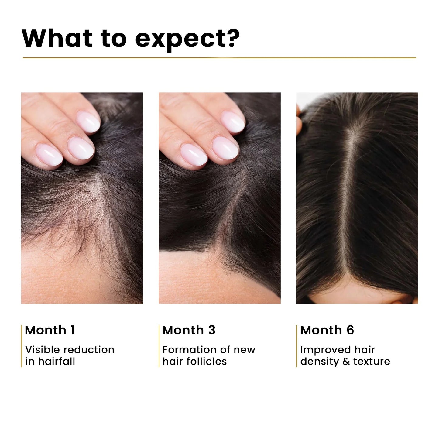 Apna Hair Oil – 100% Natural (New Hair Regrowth Solution)