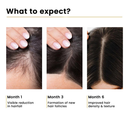 Apna Hair Oil – 100% Natural (New Hair Regrowth Solution)