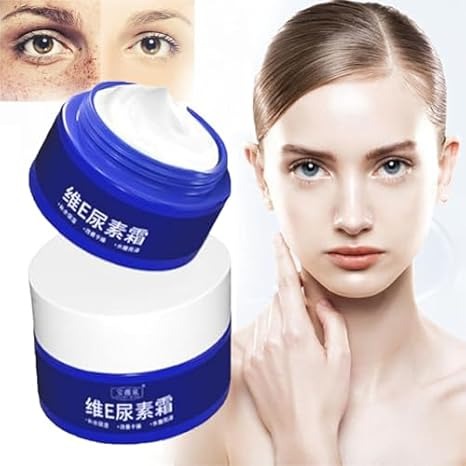 Spot Fading Urea Cream – Dark Spot Removal, Whitening & Freckle Reduction Cream