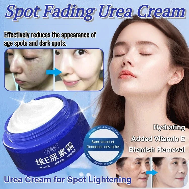 Spot Fading Urea Cream – Dark Spot Removal, Whitening & Freckle Reduction Cream